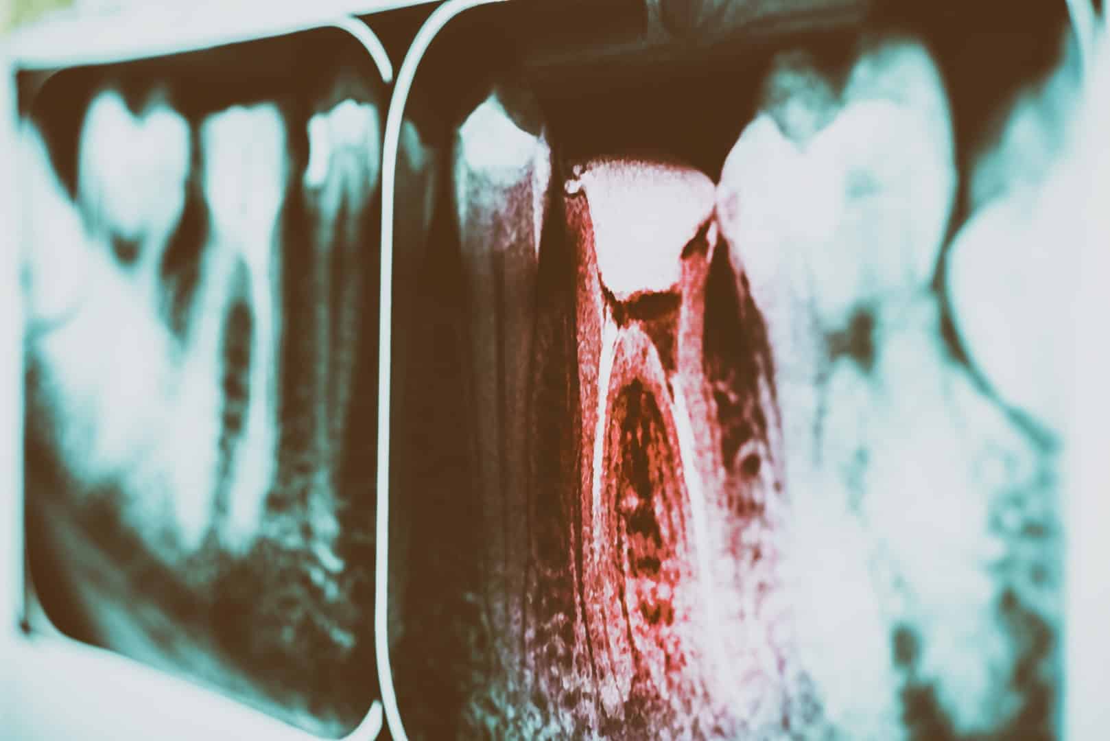 dentist in farmington