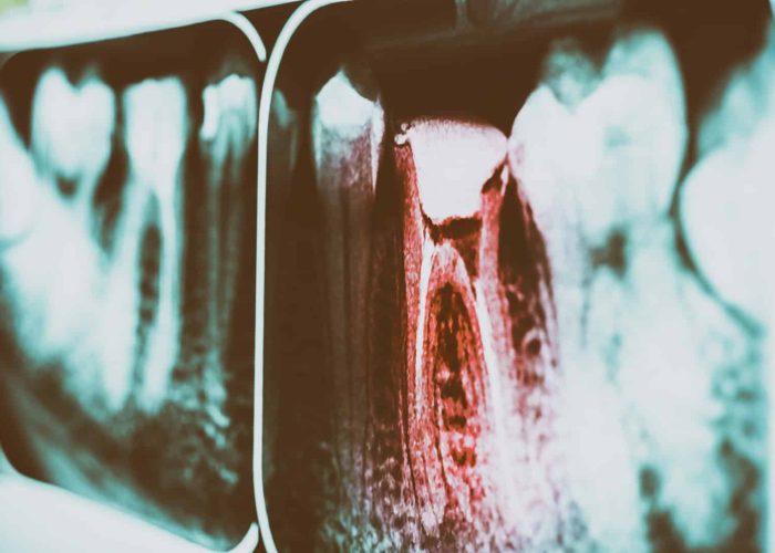 dentist in farmington
