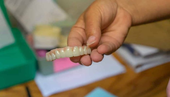 Porcelain Veneers in Durango, CO