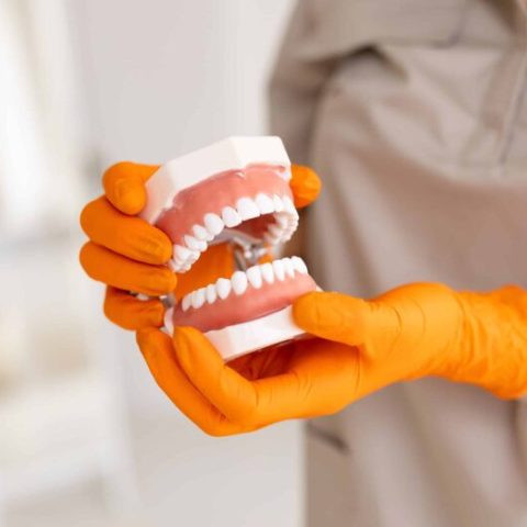 Dentist,Holding,Dentures,In,Hands.,Dental,Prosthesis,In,Doctor,Hands.